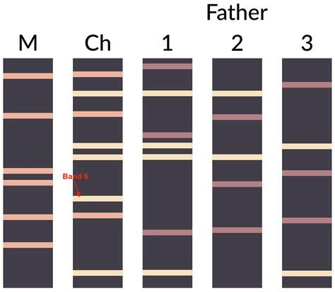 paternity testing gel electrophoresis
