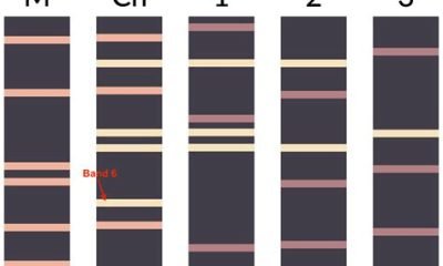 paternity testing gel electrophoresis
